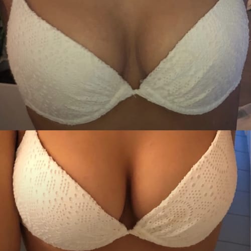 Brassiere con masaje y calor